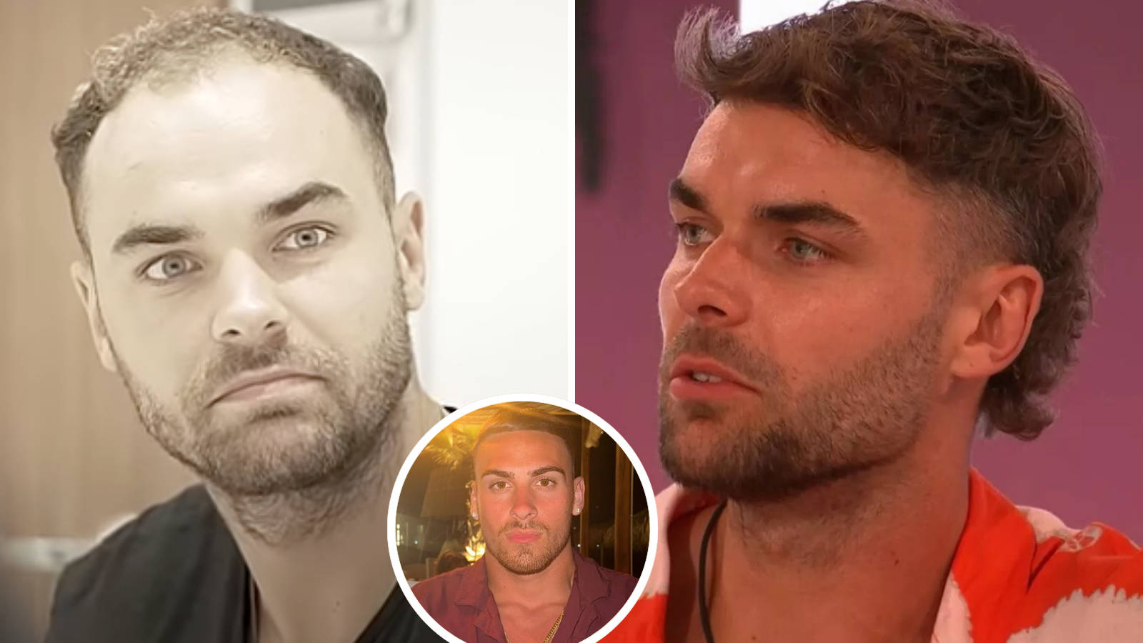 Hair Transplant UK Success Stories That Inspire Confidence